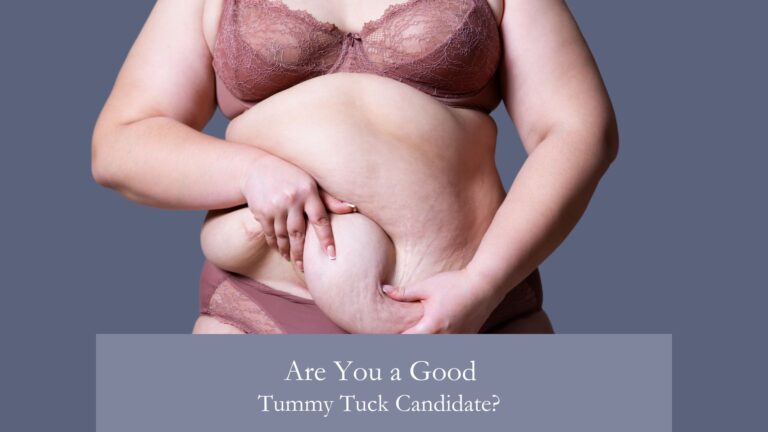 Are You a Good Tummy Tuck Candidate