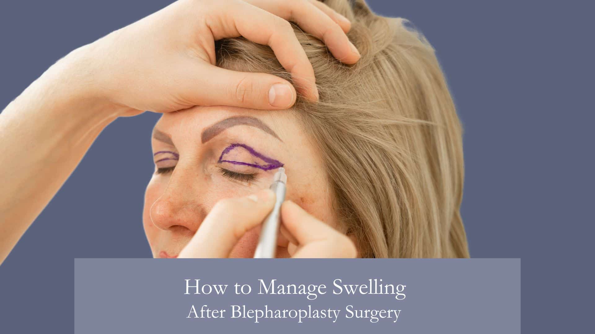 How to Manage Swelling After Blepharoplasty Surgery