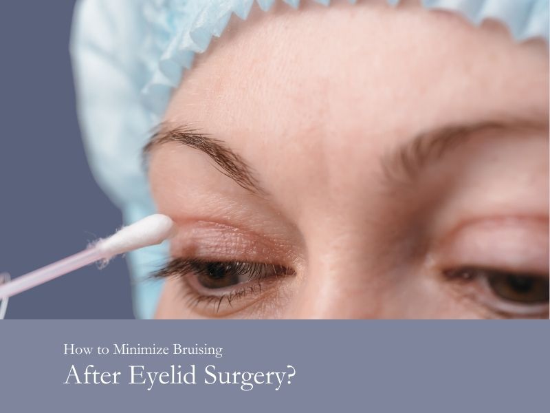 How to minimize bruising after eyelid surgery