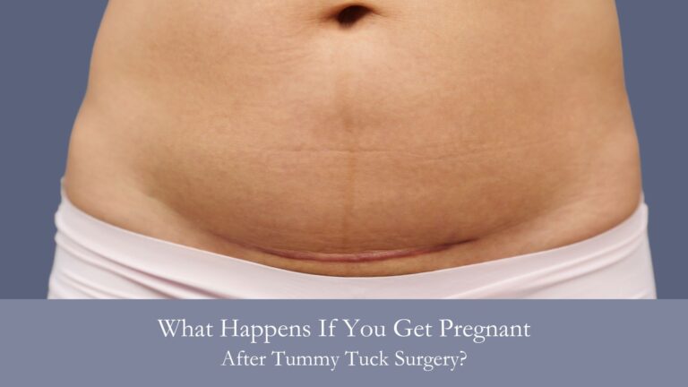 What Happens If You Get Pregnant After Tummy Tuck Surgery