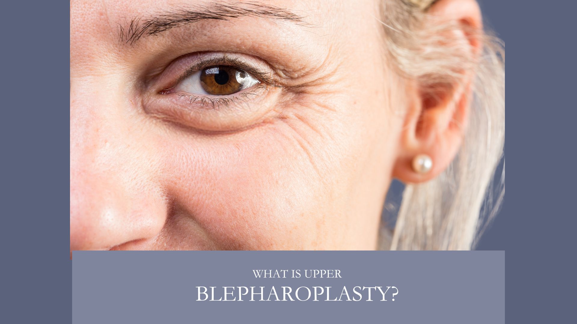 What Is Upper Blepharoplasty