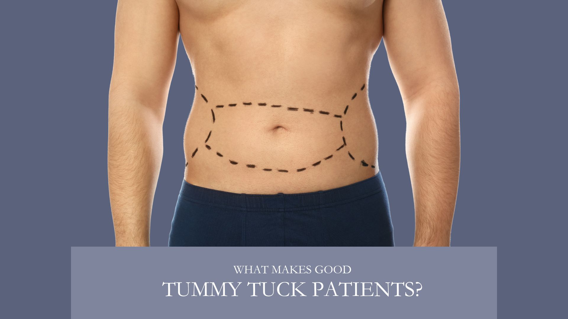 What Makes Good Tummy Tuck Patients