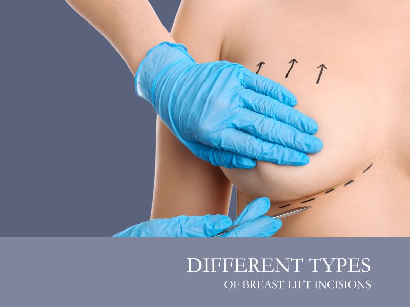 different types of breast lift incisions