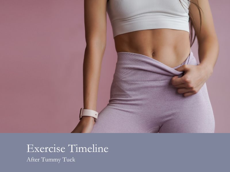 exercise timeline after tummy tuck