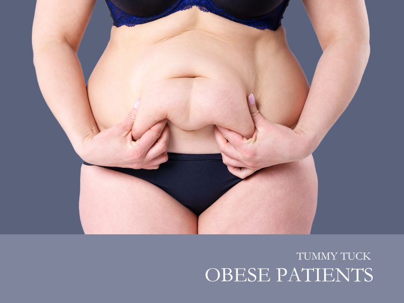 Tummy Tuck Obese Patients