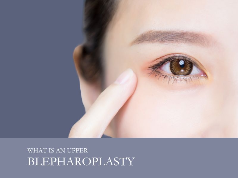 what is an upper blepharoplasty 