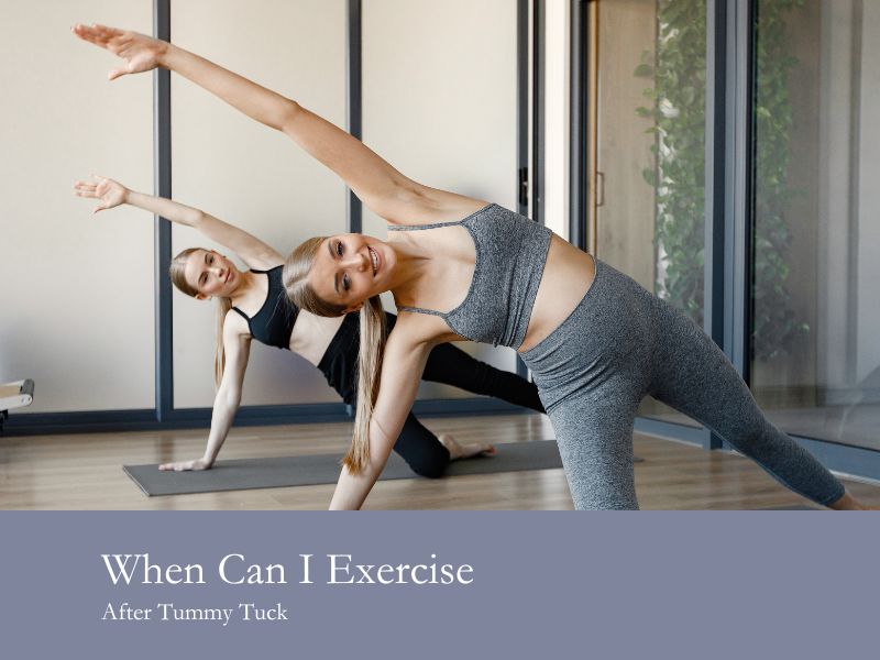 when can i exercise after tummy tuck